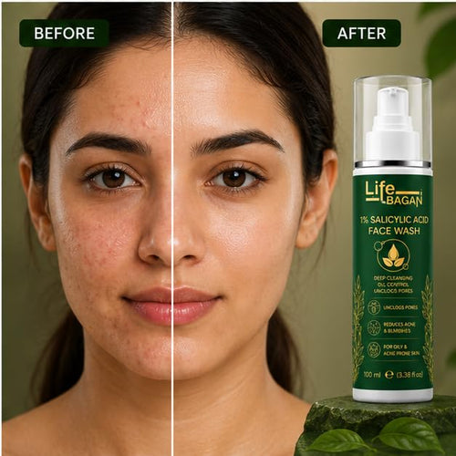 Life Bagan 1% Salicylic Acid Face Wash | Deep Cleansing Face Wash for Oily & Acne-Prone Skin | Helps Remove Excess Oil & Impurities | Daily Facial Cleanser | 100ml