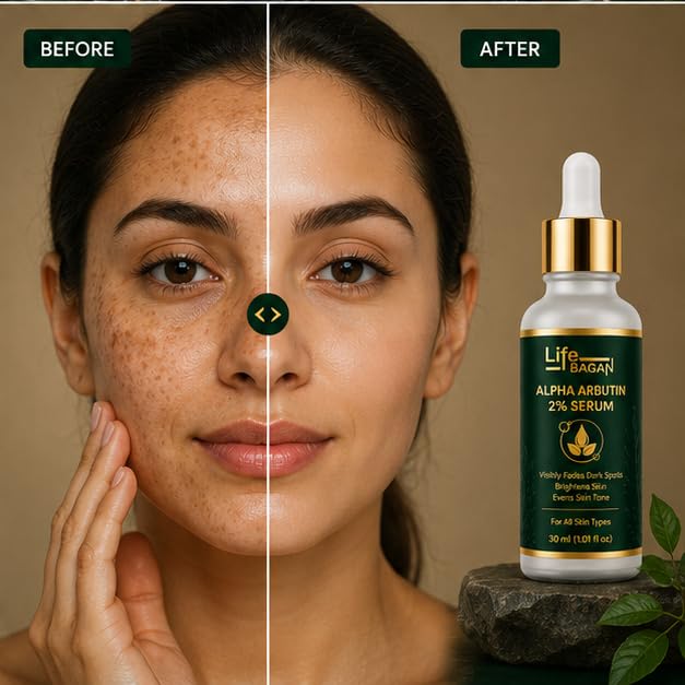 Life Bagan Alpha Arbutin 2% Face Serum | Lightweight Daily Facial Serum for Even-Looking & Healthy-Looking Skin | Fast Absorbing Formula | Suitable for All Skin Types | 30ml