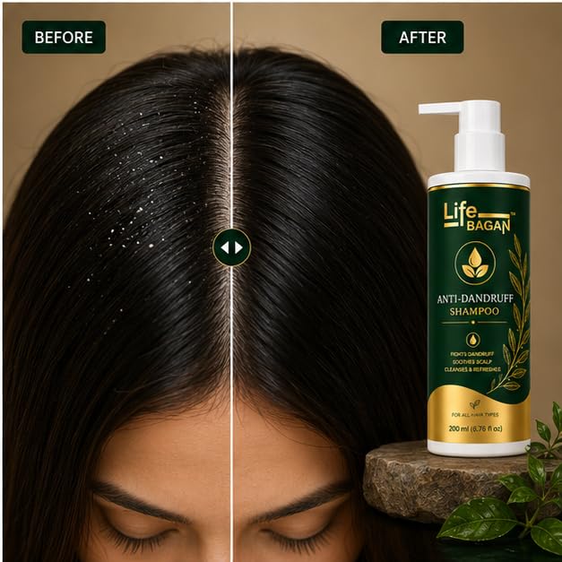 Life Bagan Anti Dandruff Shampoo | Gentle Hair & Scalp Cleanser for Fresh, Clean & Healthy-Looking Hair | Daily Hair Care Formula | Suitable for All Hair Types | 200ml