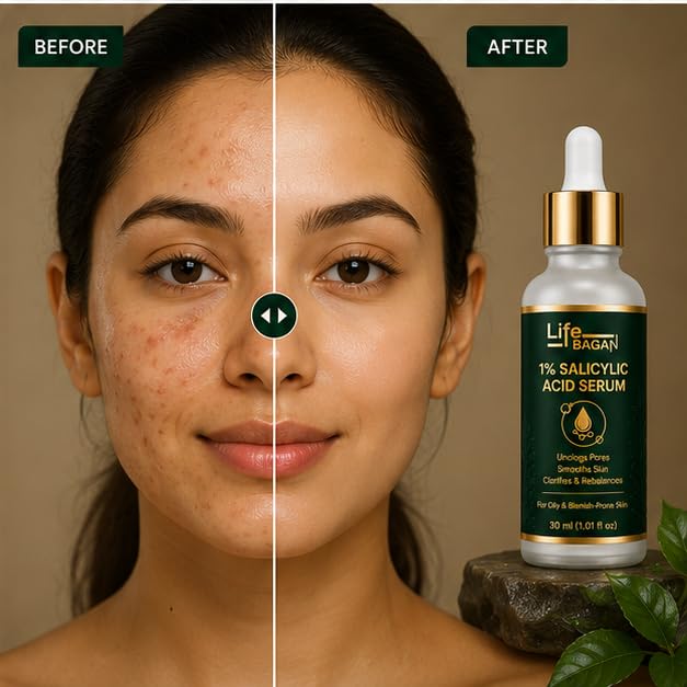 Life Bagan 1% Salicylic Acid Face Wash | Gentle Daily Facial Cleanser for Fresh & Healthy-Looking Skin | Lightweight Cleansing Formula | Suitable for Oily & Combination Skin | 30ml