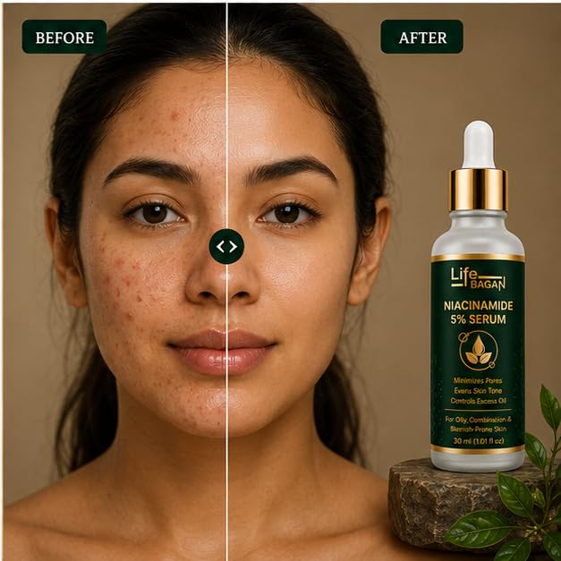 Life Bagan Niacinamide 10% Face Serum | Lightweight Daily Facial Serum for Smooth, Fresh & Healthy-Looking Skin | Fast Absorbing Formula | Suitable for All Skin Types | 30ml
